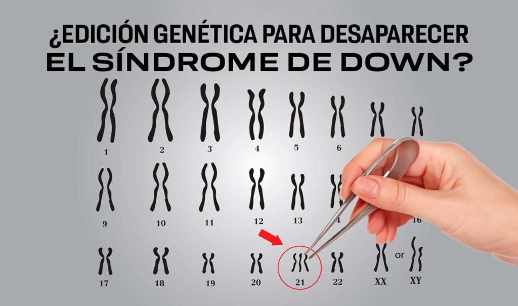 sindrome Japón prueba técnica CRISPR para silenciar el cromosoma 21 del síndrome de Down